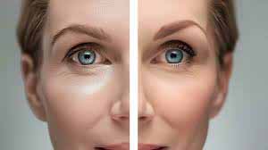 فیشال (یا فشیال یا فیشیال) چیست؟